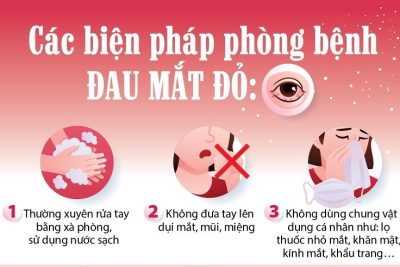 TUYÊN TRUYỀN PHÒNG CHỐNG BỆNH ĐAU MẮT ĐỎ